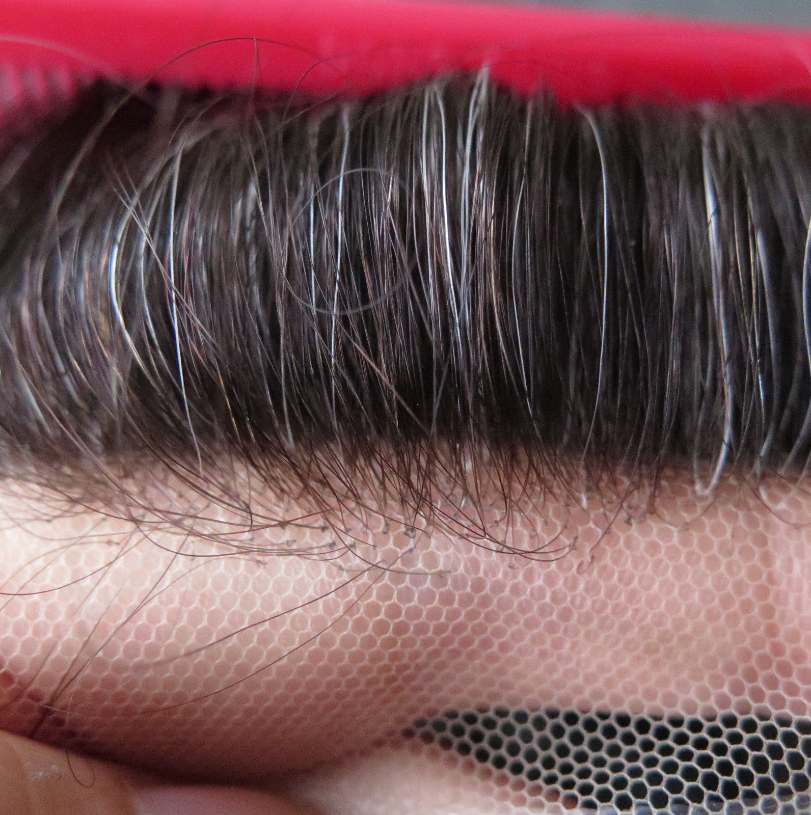 Protez Saç Ne Kadar Dayanır?