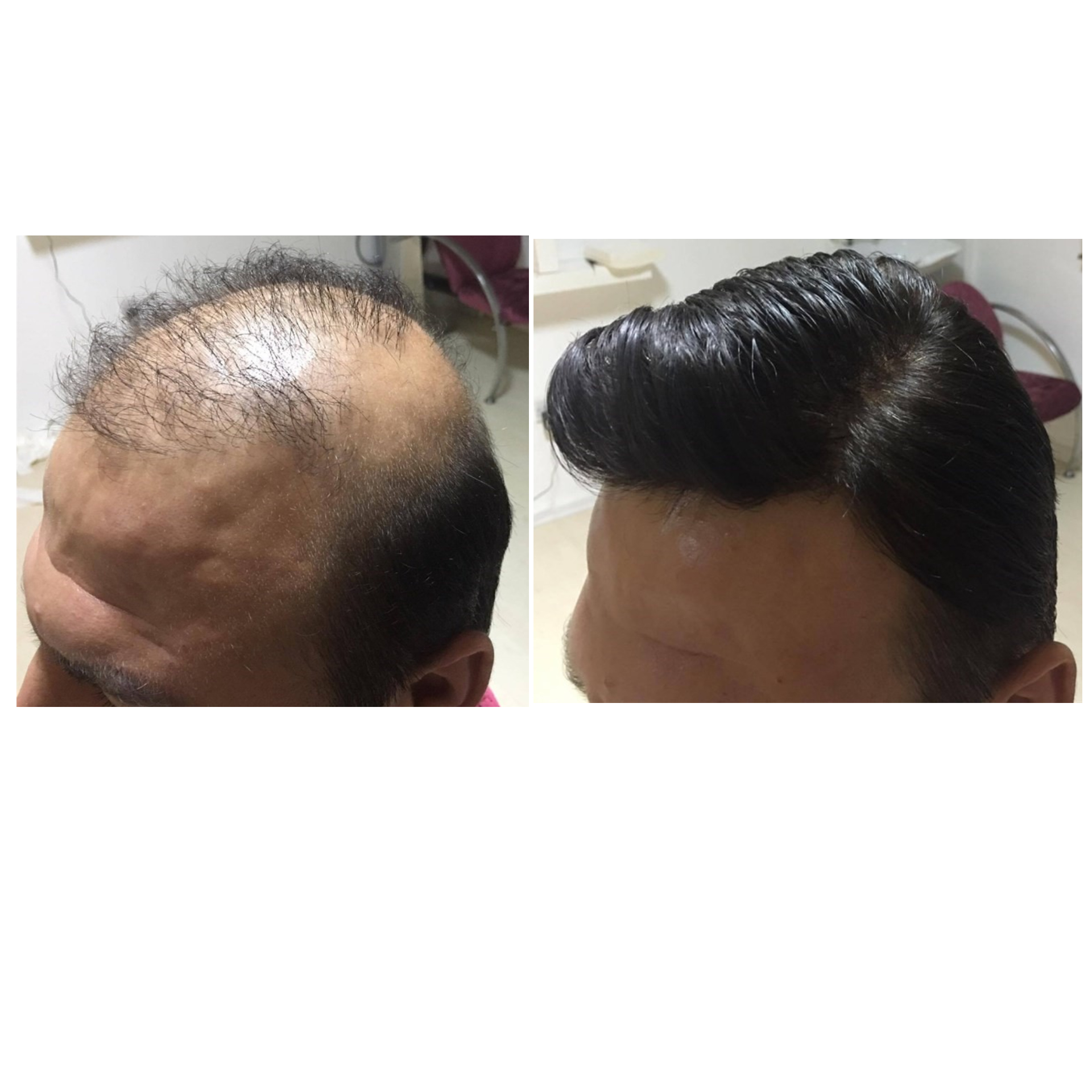 Müşterilerimizden #10