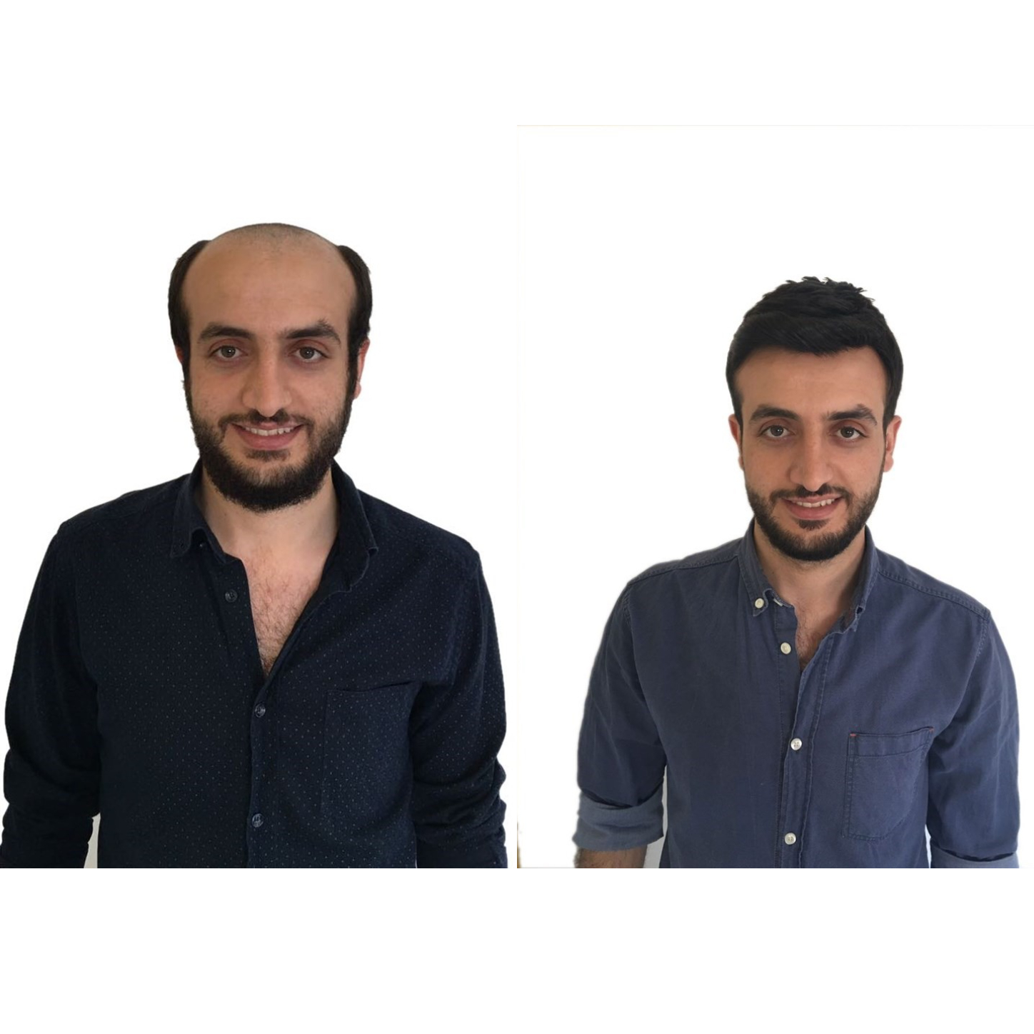 Müşterilerimizden #11