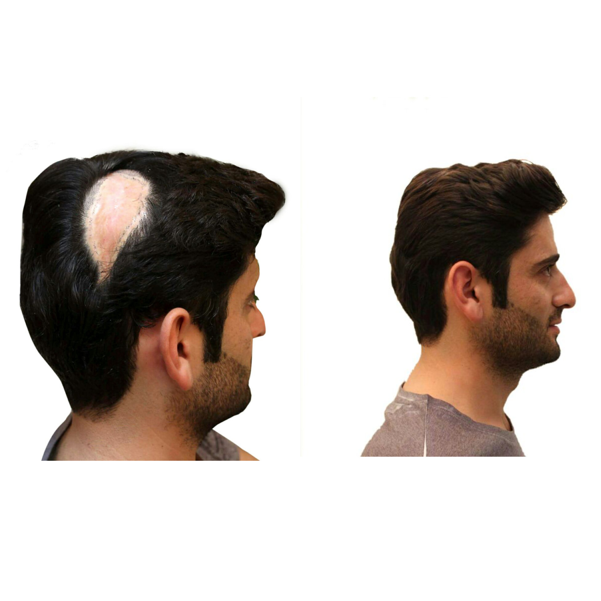 Müşterilerimizden #2